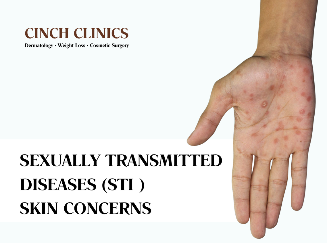 STI skin concerns at Cinch Clinics