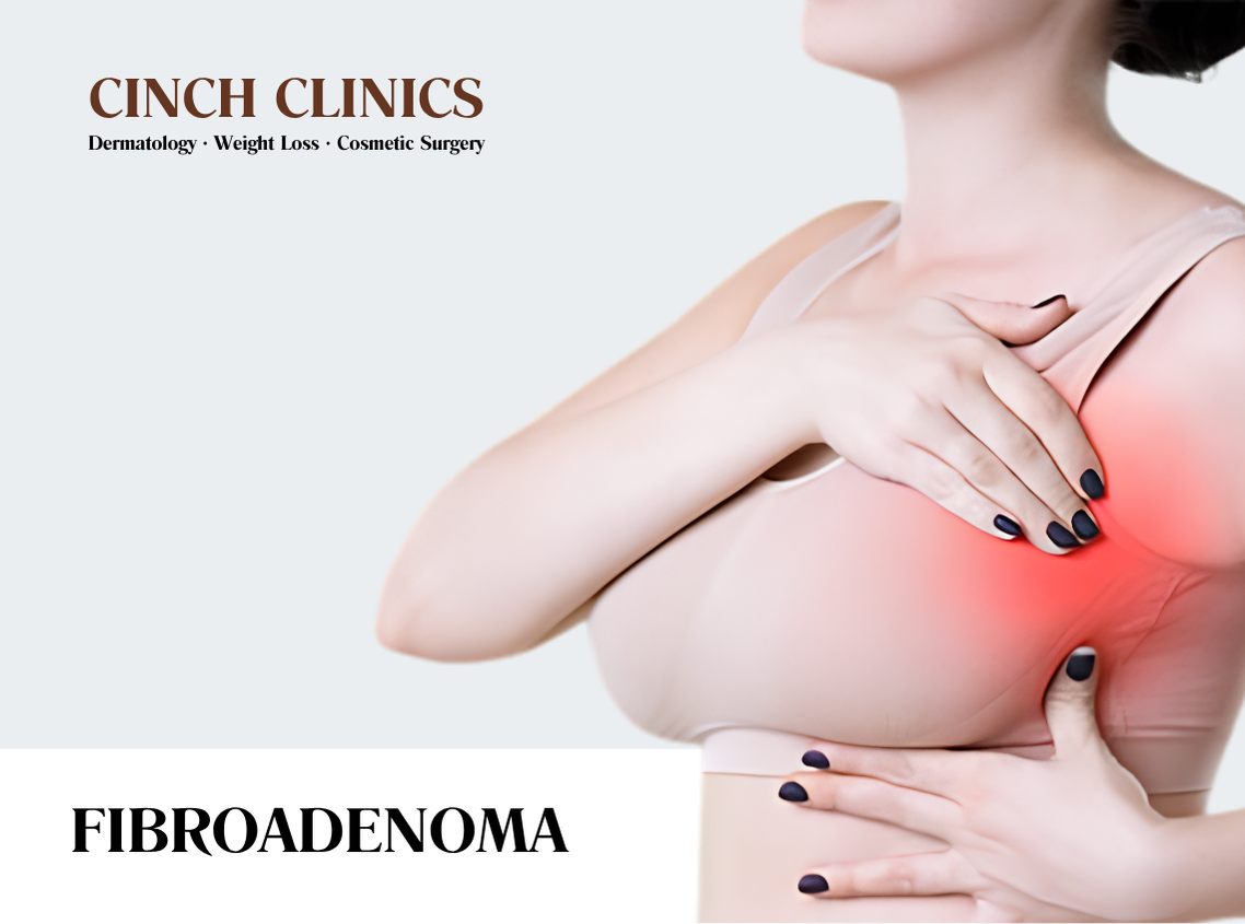 Fibroadenoma at Cinch Clinics