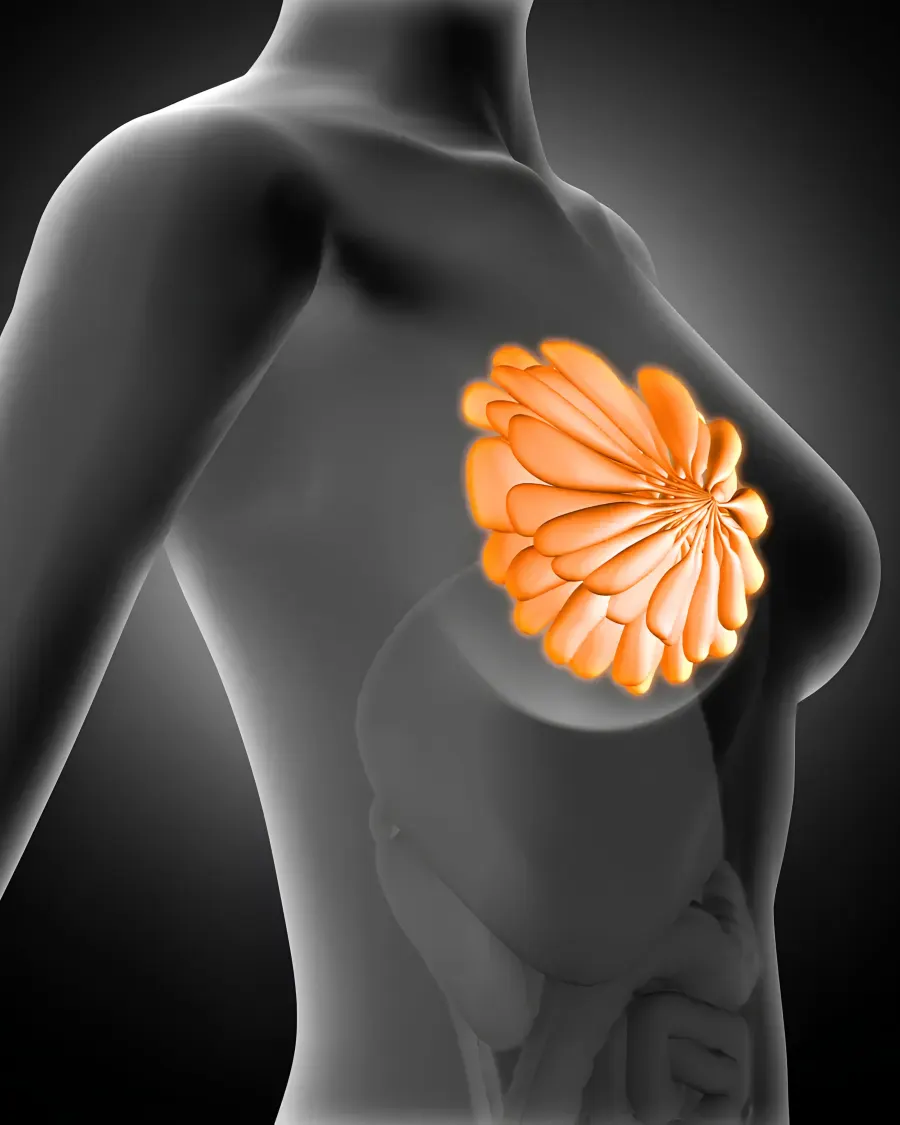 Advanced Management of Fibroadenoma at Cinch Clinics