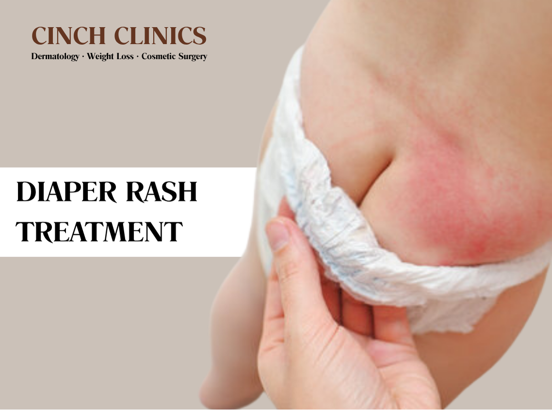 Diaper rash at Cinch Clinics