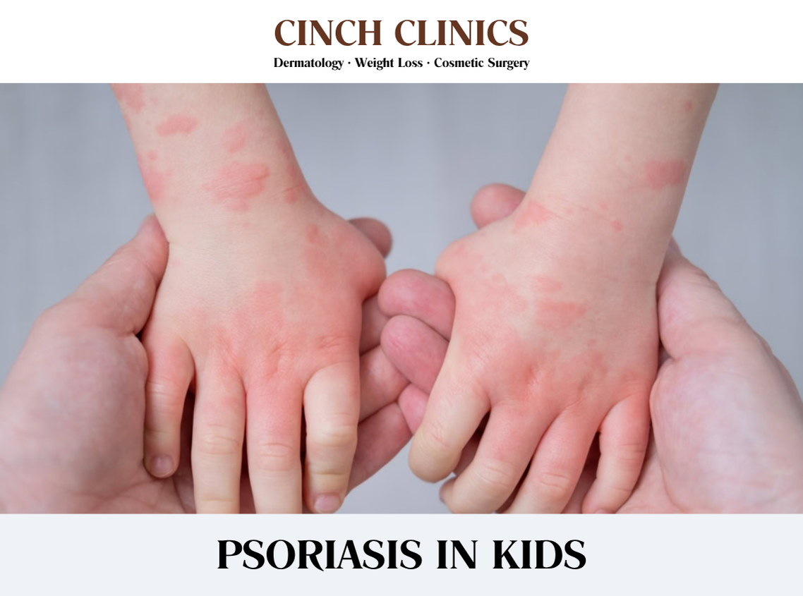Psoriasis at Cinch Clinics